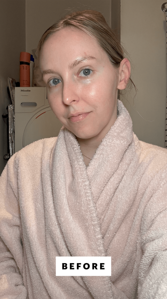 Kinonen before applying the KraveBeauty Barrier Relief Serum